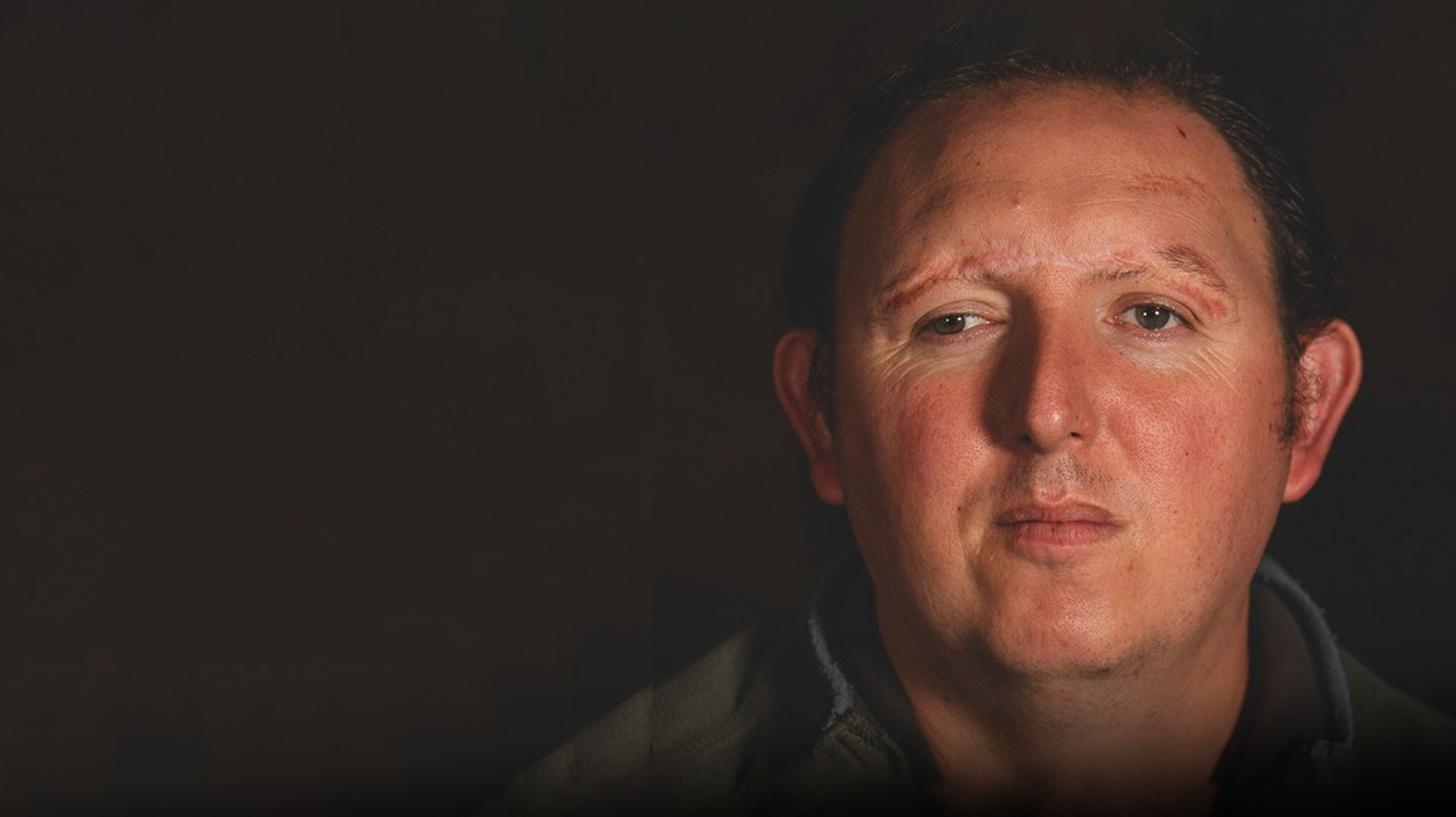 A head shot of blind veteran Chris, a healed scar is showing along his brow line, highlighting an injury he received during his time in service.