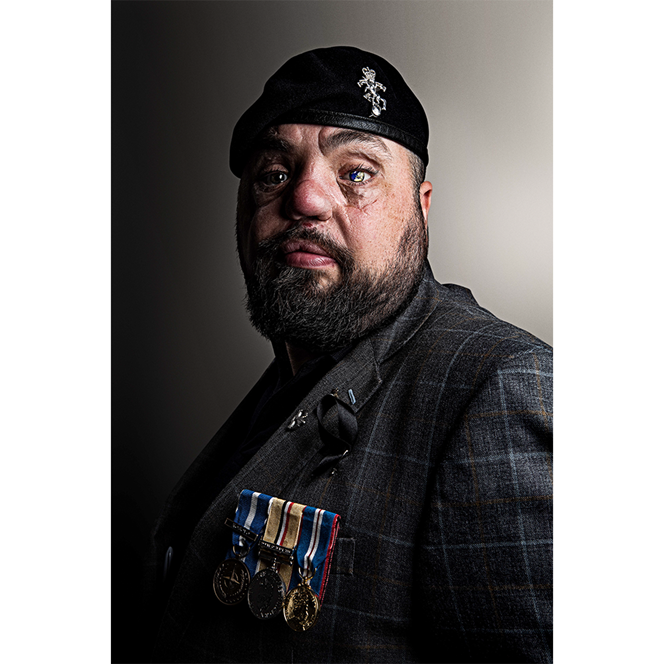 Blind veteran Simon wearing a suit jacket, beret, and medals